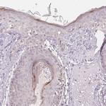 KPRP Antibody in Immunohistochemistry (Paraffin) (IHC (P))