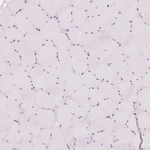 KPRP Antibody in Immunohistochemistry (Paraffin) (IHC (P))