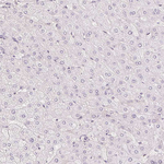 KPRP Antibody in Immunohistochemistry (Paraffin) (IHC (P))