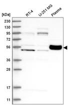 KPRP Antibody in Western Blot (WB)