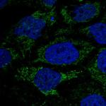 HPDL Polyclonal Antibody