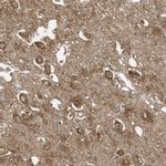 COX10 Polyclonal Antibody