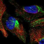 COX10 Polyclonal Antibody