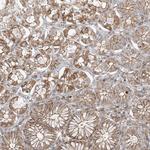ICMT Antibody in Immunohistochemistry (Paraffin) (IHC (P))