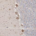 MMGT1 Antibody in Immunohistochemistry (Paraffin) (IHC (P))