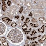 MMGT1 Antibody in Immunohistochemistry (Paraffin) (IHC (P))