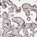 MMGT1 Antibody in Immunohistochemistry (Paraffin) (IHC (P))