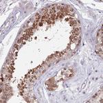 CLNS1A Antibody in Immunohistochemistry (Paraffin) (IHC (P))