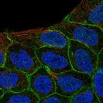 KIAA1522 Polyclonal Antibody