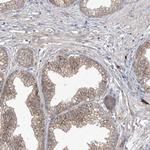 KIAA1522 Antibody in Immunohistochemistry (Paraffin) (IHC (P))