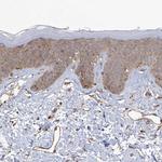 KIAA1522 Antibody in Immunohistochemistry (Paraffin) (IHC (P))