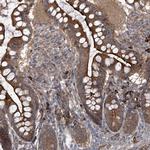 KIAA1522 Antibody in Immunohistochemistry (Paraffin) (IHC (P))
