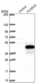 KLHDC9 Antibody in Western Blot (WB)