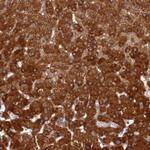 LSS Polyclonal Antibody