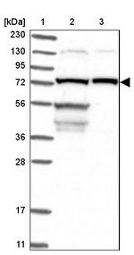 LSS Antibody in Western Blot (WB)