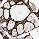 TRSPAP1 Polyclonal Antibody