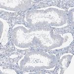TGM4 Antibody in Immunohistochemistry (Paraffin) (IHC (P))