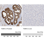 TGM4 Polyclonal Antibody
