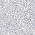 TGM4 Antibody in Immunohistochemistry (Paraffin) (IHC (P))