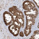 TGM4 Antibody in Immunohistochemistry (Paraffin) (IHC (P))
