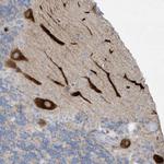 TUBE1 Polyclonal Antibody