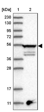 TUBE1 Antibody in Western Blot (WB)