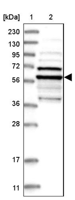 TUBE1 Antibody in Western Blot (WB)