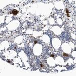 GPATCH3 Polyclonal Antibody