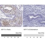 KIF17 Antibody in Immunohistochemistry (IHC)