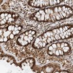 TATDN3 Antibody in Immunohistochemistry (Paraffin) (IHC (P))