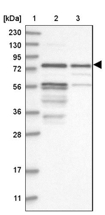 Kazrin Antibody in Western Blot (WB)