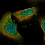 NAV3 Polyclonal Antibody