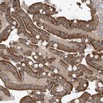 NAV3 Antibody in Immunohistochemistry (Paraffin) (IHC (P))