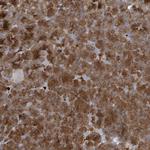NAV3 Polyclonal Antibody