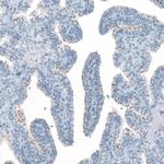 FAM161A Polyclonal Antibody