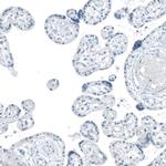 FAM161A Antibody in Immunohistochemistry (Paraffin) (IHC (P))