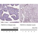 FAM161A Antibody in Immunohistochemistry (IHC)