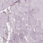 FAM161A Antibody in Immunohistochemistry (IHC)