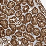 ARHGAP15 Polyclonal Antibody