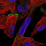 ORP6 Polyclonal Antibody