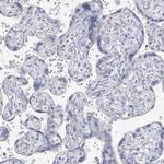 ORP6 Antibody in Immunohistochemistry (Paraffin) (IHC (P))