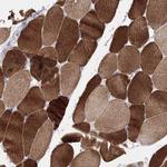 ORP6 Antibody in Immunohistochemistry (Paraffin) (IHC (P))