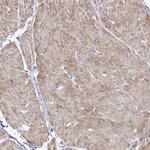 ORP6 Antibody in Immunohistochemistry (Paraffin) (IHC (P))