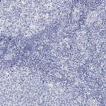 ORP6 Antibody in Immunohistochemistry (Paraffin) (IHC (P))