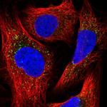 PEX13 Polyclonal Antibody