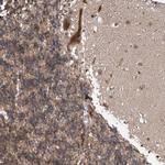 ABHD13 Antibody in Immunohistochemistry (Paraffin) (IHC (P))