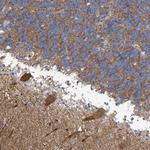 ABHD13 Antibody in Immunohistochemistry (Paraffin) (IHC (P))
