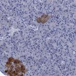 FOXR2 Antibody in Immunohistochemistry (Paraffin) (IHC (P))