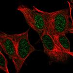 FOXR2 Polyclonal Antibody