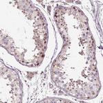 CF106 Polyclonal Antibody